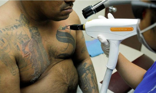 Expandilleros salvadoreños buscan eliminar tatuajes para borrar estigmas