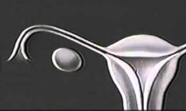 La menstruación contada por Disney