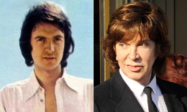 Cirujanos plásticos que hicieron desastres con los famosos