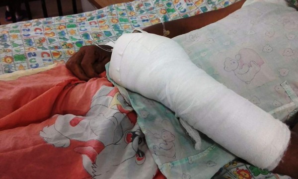Honduras: 24 pacientes mutilados dejó la Navidad
