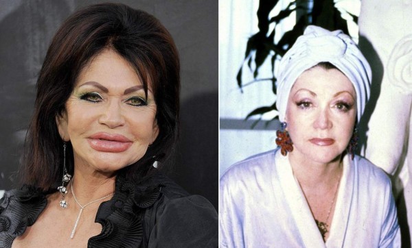 Famosos que lucen terribles después de las cirugías