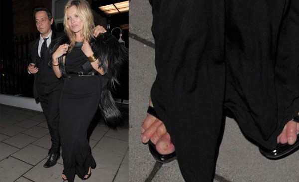 Celebridades que se hicieron más famosos por tener los pies espantosos