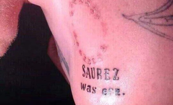 Se tatúa mordisco de Suárez pero... algo salió mal