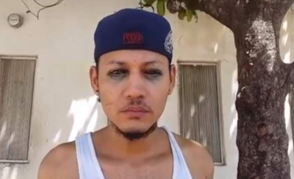 Hieren con machete a joven hondureño que se tatuó sus ojos