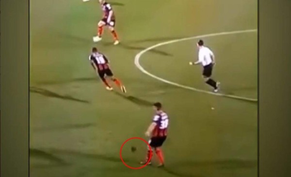 Jugador pierde peluca en pleno partido contra el Liverpool&nbsp;&nbsp;