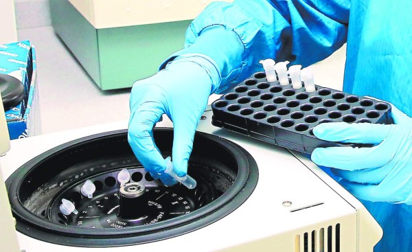 Un millón de lempiras ha invertido la UNAH para detectar el virus del zika