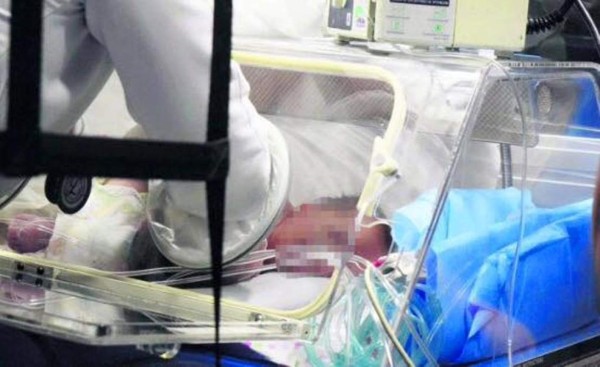 Siameses mueren a solo minutos de nacer en el Materno Infantil