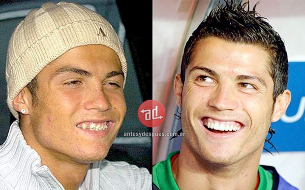 VIDEO: Evolución del rostro de Cristiano Ronaldo