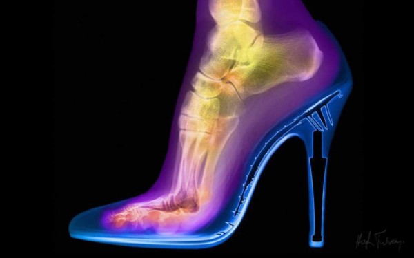 Tacones por ¿estética o salud? Usted decide