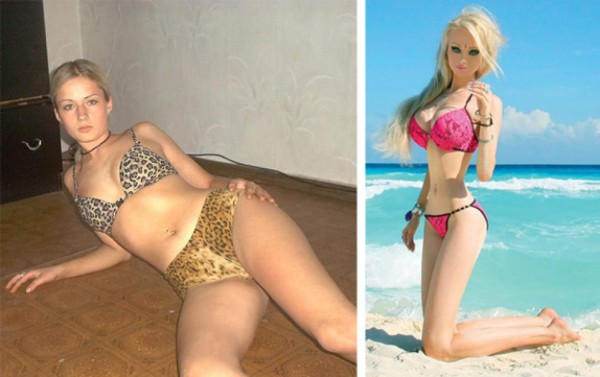 Así lucía la ''Barbie humana'' antes de las cirugías