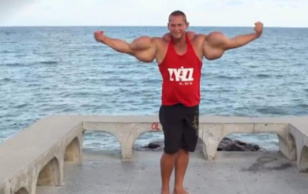 VIDEO: Desarrolló súper músculos con inyecciones de aceite y alcohol