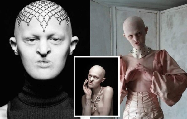 Modelo con inusual apariencia rompe estereotipos de belleza