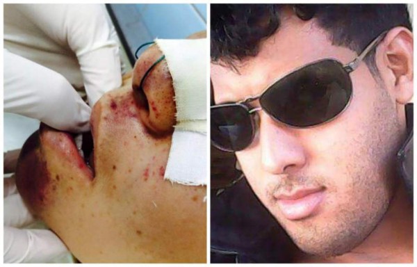 Dictan prisión preventiva a sujeto que le propinó golpiza a su pareja&nbsp;&nbsp;