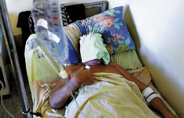 Bacteria 'comecarne” podría desatar epidemia