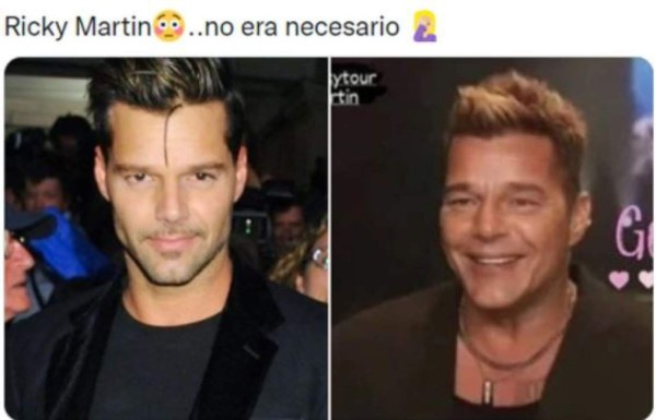 Ricky Martin se retoca la cara y desata una ola de memes
