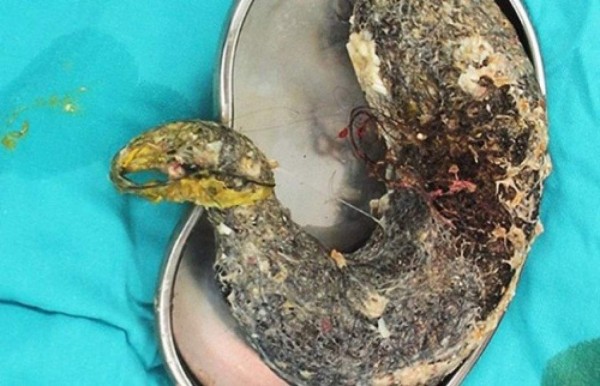 Pelos en su estómago