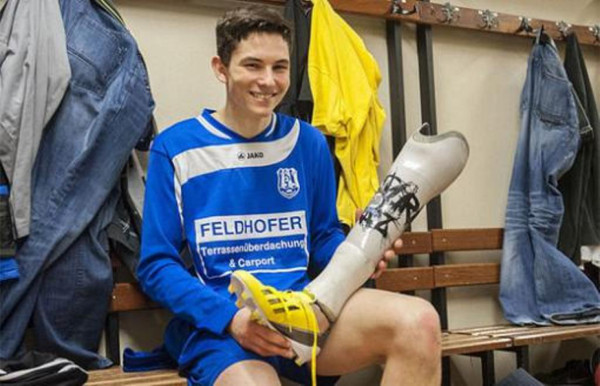 La FIFA autoriza a futbolista amputado de una pierna a jugar con prótesis