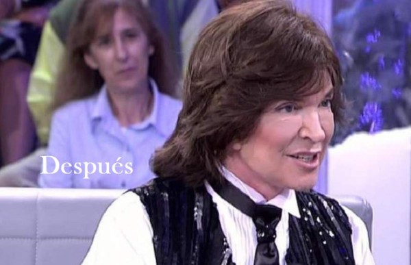 Los memes y las burlas más sonadas por el rostro de Camilo Sesto