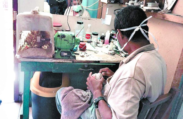 Falsos odontólogos en la mira del Ministerio Público de Honduras