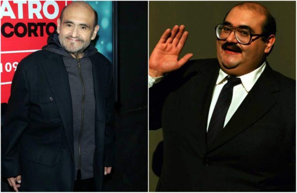 Empeora la salud del 'Señor Barriga' después de perder peso drásticamente