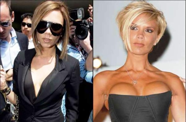 El antes y después de las bubis de las famosas