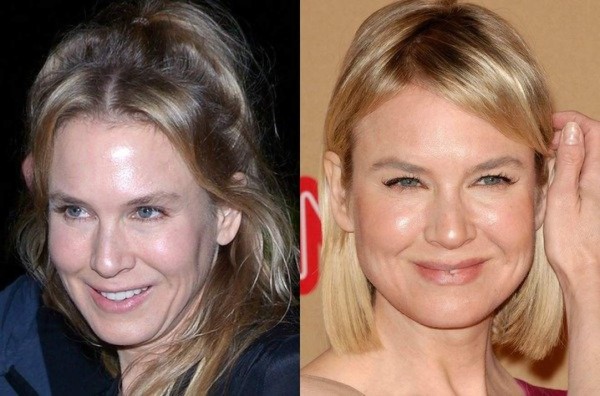 Renée Zellweger explica lo que le ocurrió a su rostro