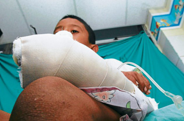 Niño de La Paz, nueva víctima de la pólvora