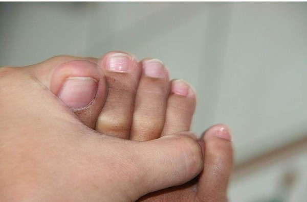 10 tipos de pie y lo que dicen sobre tu personalidad ¡Toma nota!