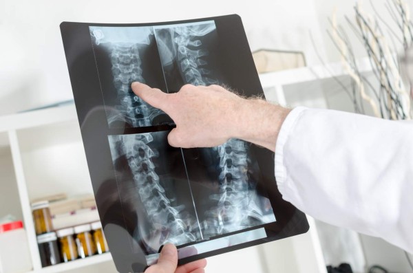 Imágenes radiologicas