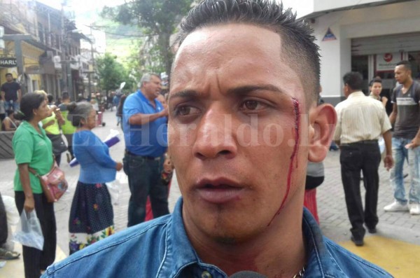 Vendedores ambulantes y policías municipales se enfrentan en el centro de Tegucigalpa