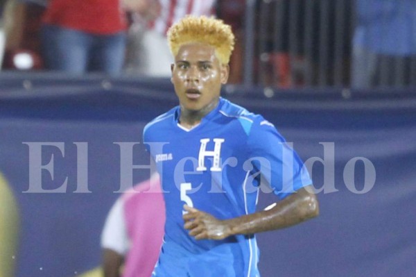 GALERIA: Henry Figueroa, el señor de los peinados ahora luce el estilo Bob Patiño