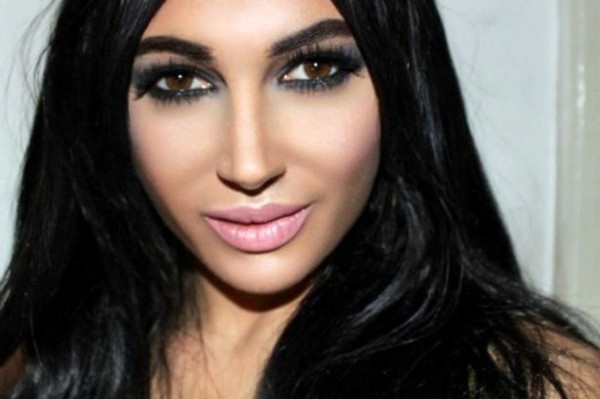 Personas comunes que se operaron para parecerse a famosos; algunos no lo lograron