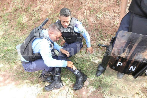 Impactantes fotos: Batalla campal fuera de la UNAH deja varios policías con quemaduras