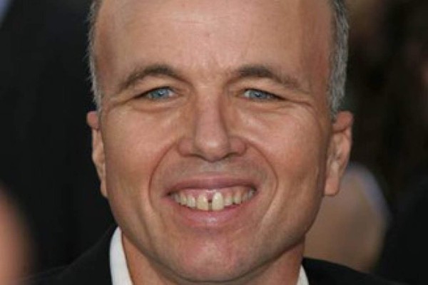 Famosos con sonrisas imperfectas