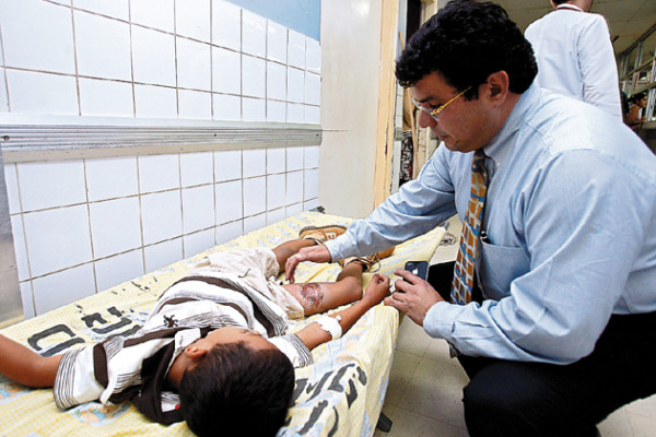 Dos niños quemados por pólvora