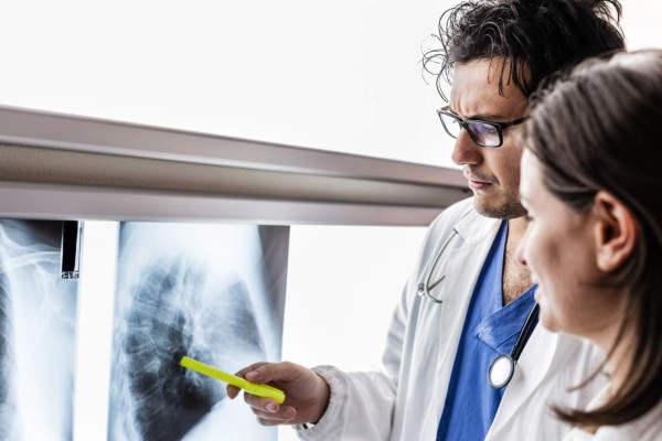 Cáncer de pulmón