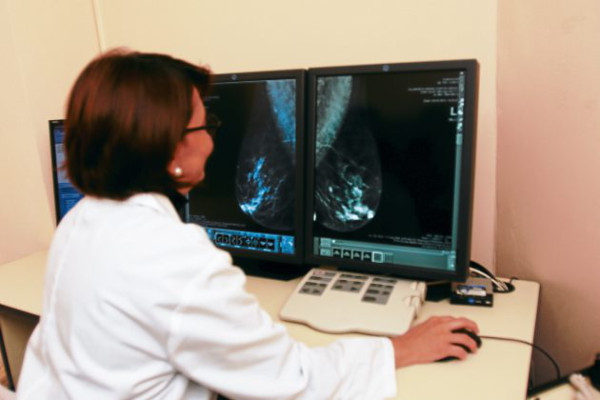 Refuerzan lucha contra el cáncer de mama