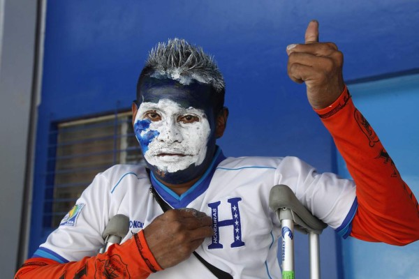 Olman, un ejemplo de garra catracha