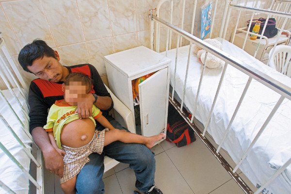 Le extraerán gemelo parásito a niño en Perú