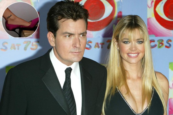 Borraron de su piel los amores del pasado plasmados en tatuajes