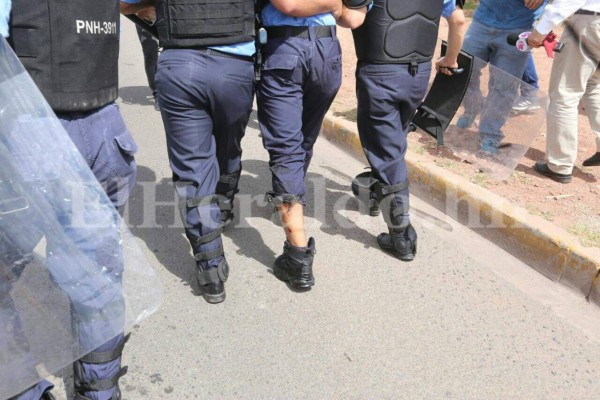 Impactantes fotos: Batalla campal fuera de la UNAH deja varios policías con quemaduras