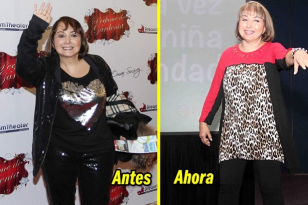 ¿Qué le pasó a la Chilindrina en el rostro?