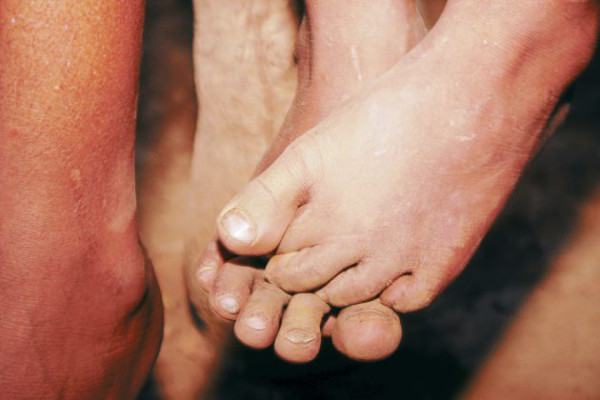 El Heraldo y Buckner calzaron a niños en sur de Honduras