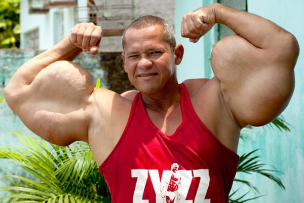 VIDEO: Desarrolló súper músculos con inyecciones de aceite y alcohol