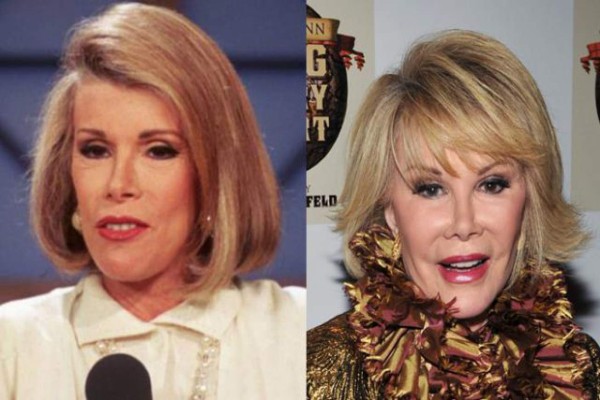 Las mil y una caras de la presentadora Joan Rivers