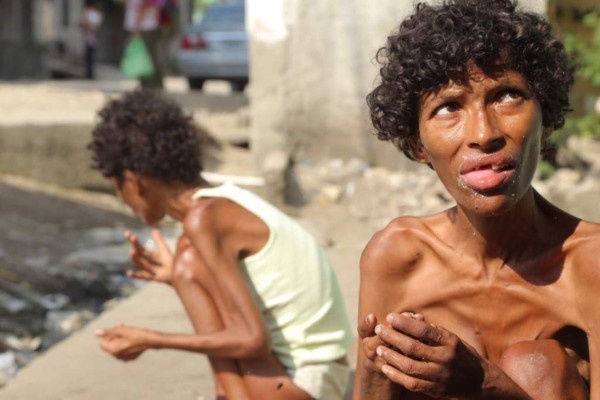 Honduras: Emiten orden de captura contra padre que abandonó a gemelas con transtorno mental