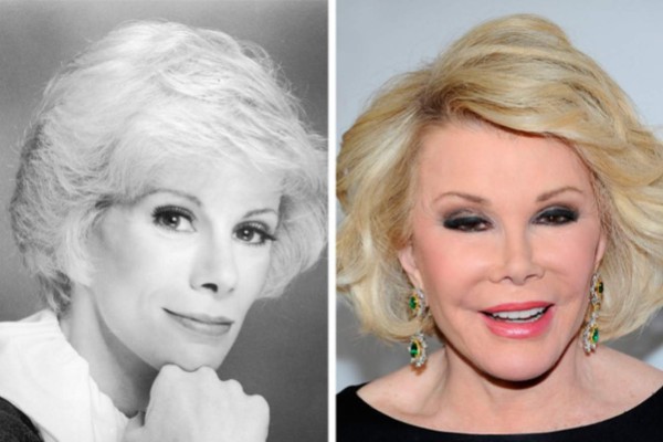 Las mil y una caras de la presentadora Joan Rivers