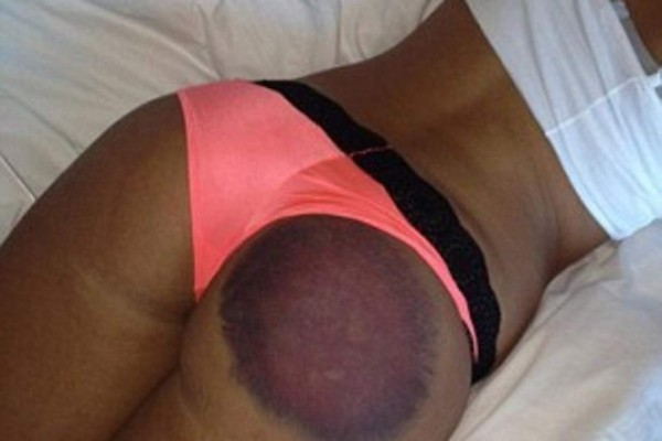 Modelo demanda a Playboy por golpe de golf en los glúteos