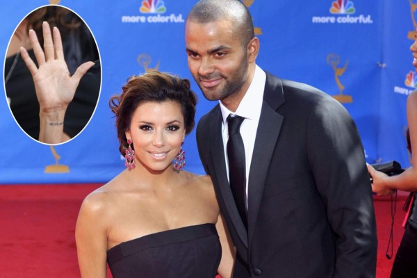 Borraron de su piel los amores del pasado plasmados en tatuajes