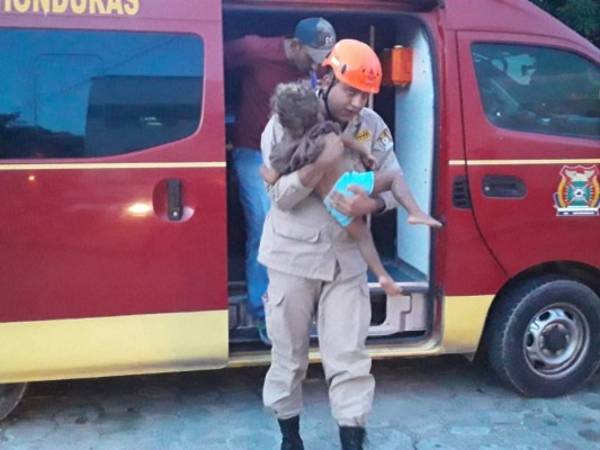 Las lesiones en la menor cubren un 30 por ciento de su cuerpo, por lo que requerirá atención especializada.